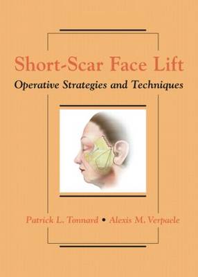 Short-Scar Face Lift: Operative Strategies and Techniques (Hardback)