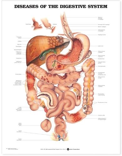 Diseases of the Digestive System Anatomical Chart (Wallchart)
