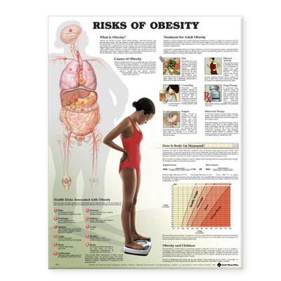 Risks of Obesity Anatomical Chart (Wallchart)