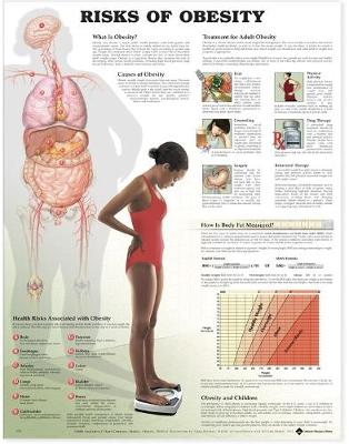 Risks of Obesity Anatomical Chart (Wallchart)