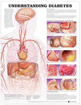 Understanding Diabetes Anatomical Chart (Wallchart)