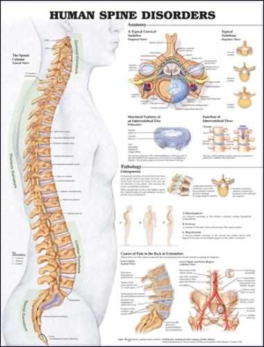 Human Spine Disorders Anatomical Chart (Wallchart)