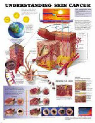 Understanding Skin Cancer (Wallchart)