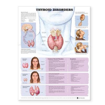 Thyroid Disorders Anatomical Chart (Wallchart)