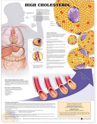 High Cholesterol Anatomical Chart (Wallchart)