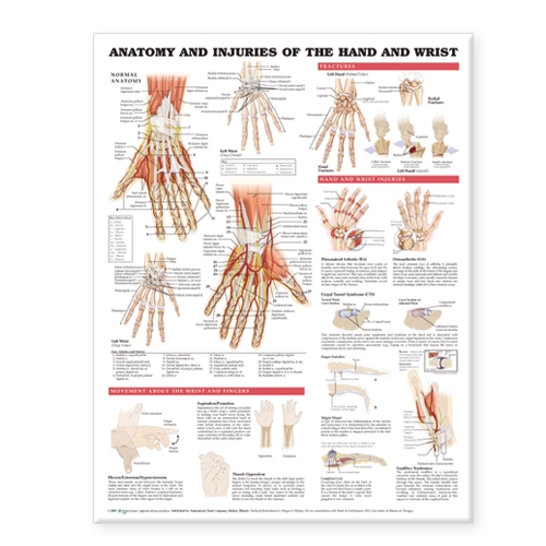 Anatomy and Injuries of the Hand and Wrist Anatomical Chart (Wallchart)