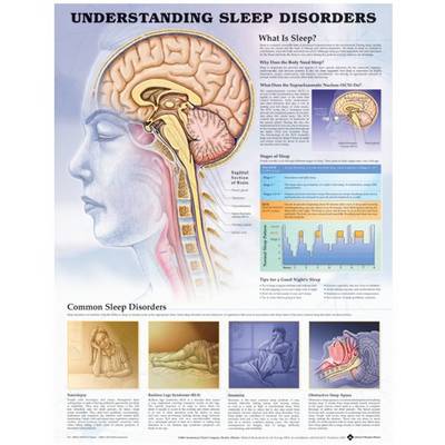 Understanding Sleep Disorders Anatomical Chart (Wallchart)
