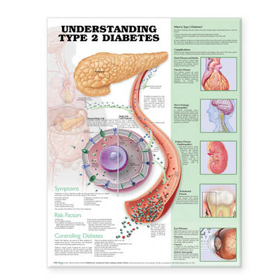 Understanding Type 2 Diabetes Anatomical Chart (Wallchart)