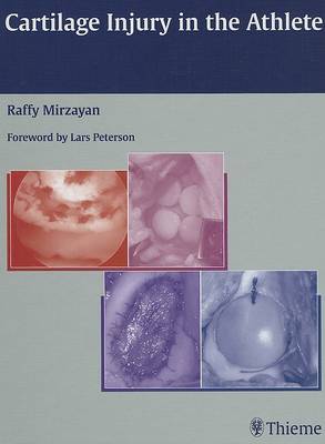 Cartilage Injury in the Athlete (Hardback)
