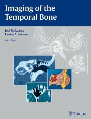 Imaging of the Temporal Bone (Hardback)
