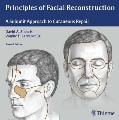 Principles of Facial Reconstruction: A Subunit Approach to Cutaneous Repair (Hardback)