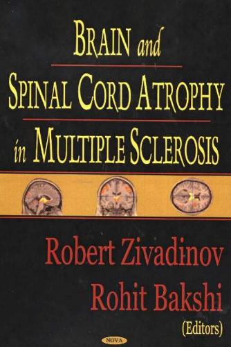 Brain & Spinal Cord Atrophy in Multiple Sclerosis (Hardback)