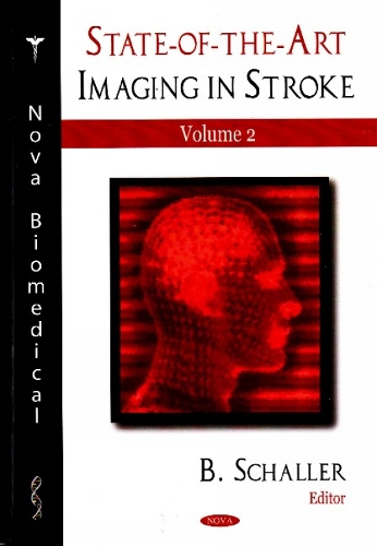 State-of-the-Art Imaging in Stroke: Volume 2 (Hardback)