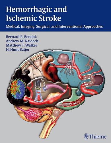 Hemorrhagic and Ischemic Stroke: Medical, Imaging, Surgical and Interventional Approaches (Hardback)