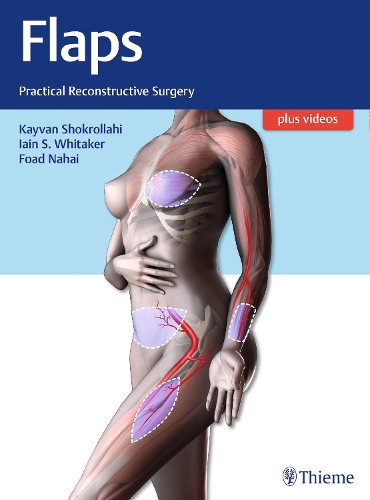 Flaps: Practical Reconstructive Surgery (Hardback)