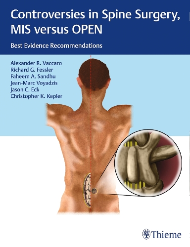 Controversies in Spine Surgery, MIS versus OPEN: Best Evidence Recommendations (Hardback)