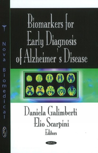 Biomarkers for Early Diagnosis of Alzheimer's Disease (Hardback)