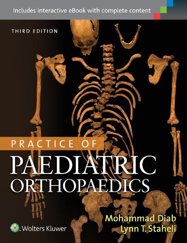 Practice of Paediatric Orthopaedics (Hardback)