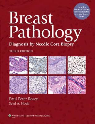 Breast Pathology by Paul Peter Rosen, Syed A. Hoda | Waterstones