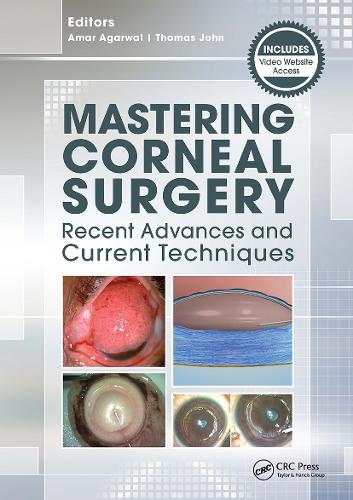 Mastering Corneal Surgery: Recent Advances and Current Techniques (Paperback)