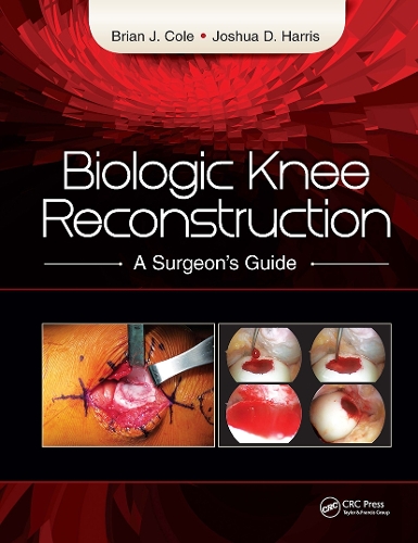 Biologic Knee Reconstruction: A Surgeon's Guide (Hardback)