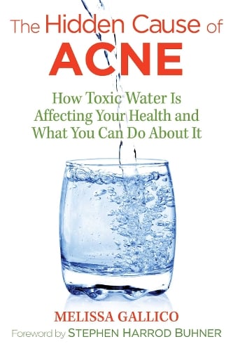 The Hidden Cause of Acne: How Toxic Water Is Affecting Your Health and What You Can Do about It (Paperback)