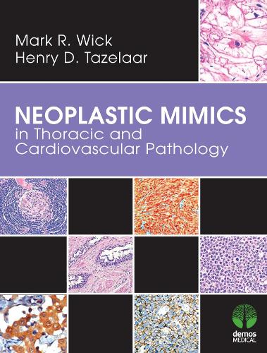 Neoplastic Mimics in Thoracic and Cardiovascular Pathology (Hardback)