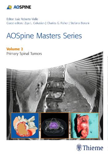 AOSpine Masters Series Volume 2: Primary Spinal Tumors - AOSpine Masters Series (Hardback)