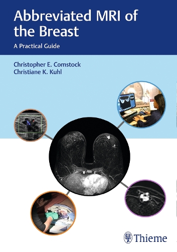 Abbreviated MRI of the Breast: A Practical Guide (Hardback)