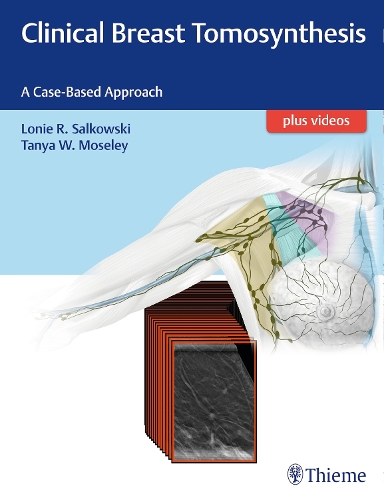Clinical Breast Tomosynthesis: A Case-Based Approach (Hardback)