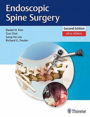Endoscopic Spine Surgery (Hardback)