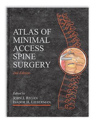 Atlas of Minimal Access Spine Surgery (Hardback)