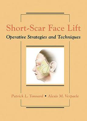 Short-Scar Face Lift: Operative Strategies and Techniques (Hardback)