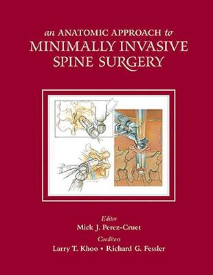 An Anatomic Approach to Minimally Invasive Spine Surgery (Hardback)
