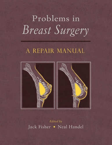 Problems in Breast Surgery: A Repair Manual (Hardback)