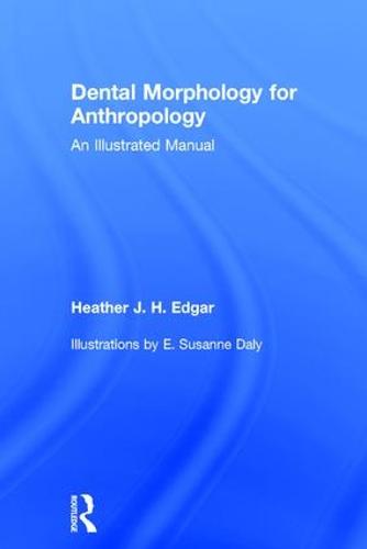 Dental Morphology for Anthropology: An Illustrated Manual (Hardback)