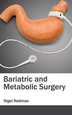 Bariatric and Metabolic Surgery (Hardback)