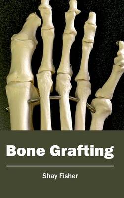 Bone Grafting (Hardback)