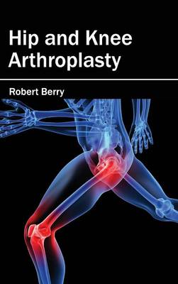 Hip and Knee Arthroplasty (Hardback)