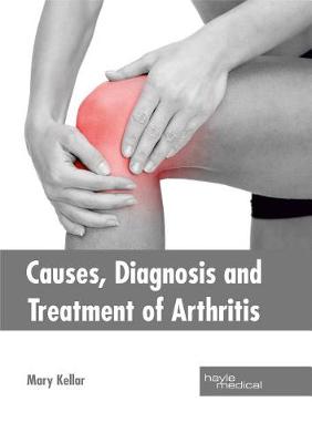 Causes, Diagnosis and Treatment of Arthritis (Hardback)