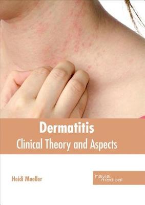 Dermatitis: Clinical Theory and Aspects (Hardback)