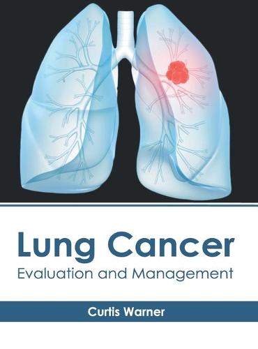 Lung Cancer: Evaluation and Management (Hardback)