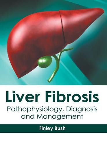 Liver Fibrosis: Pathophysiology, Diagnosis and Management by Finley ...