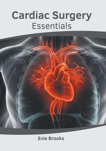 Cardiac Surgery Essentials (Hardback)