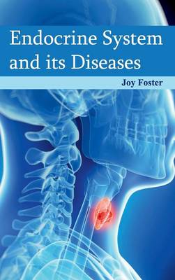 Endocrine System and Its Diseases (Hardback)