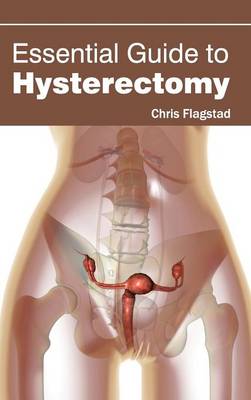 Essential Guide to Hysterectomy (Hardback)