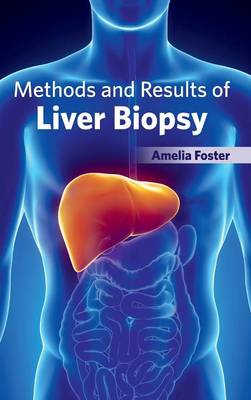 Methods and Results of Liver Biopsy (Hardback)