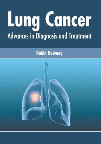 Lung Cancer: Advances in Diagnosis and Treatment (Hardback)