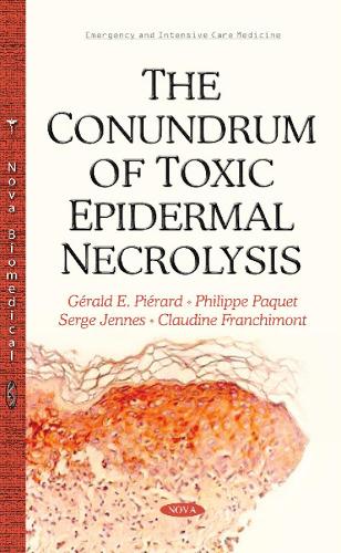 Conundrum of Toxic Epidermal Necrolysis (Hardback)