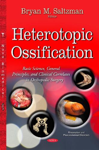 Heterotopic Ossification: Basic Science, General Principles & Clinical Correlates in Orthopedic Surgery (Hardback)